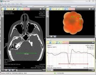 Ginkgo CADx DICOM viewer